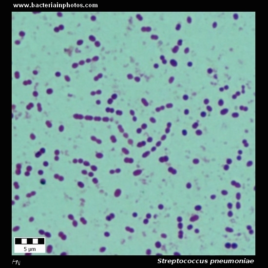 Streptococcus pneumoniae   
                         microscopy, lanceolate gram-positive cocci